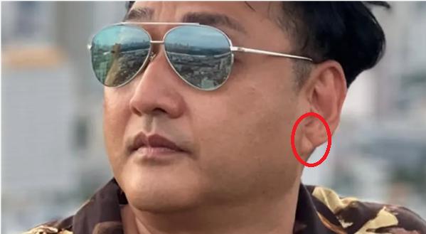 김수용 귓볼.png